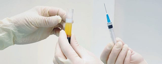 Regenerative therapies