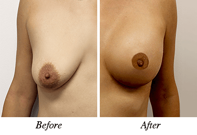 Patient 24 - before and after intervention