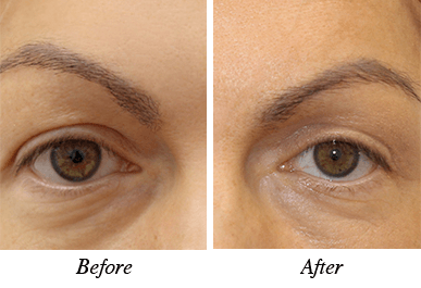 Patient 2 - Before and after intervention Patient 2 - Before and after intervention