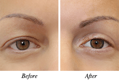 Patient 3 - Before and after intervention