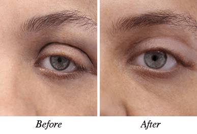 Patient 5 - Before and after intervention