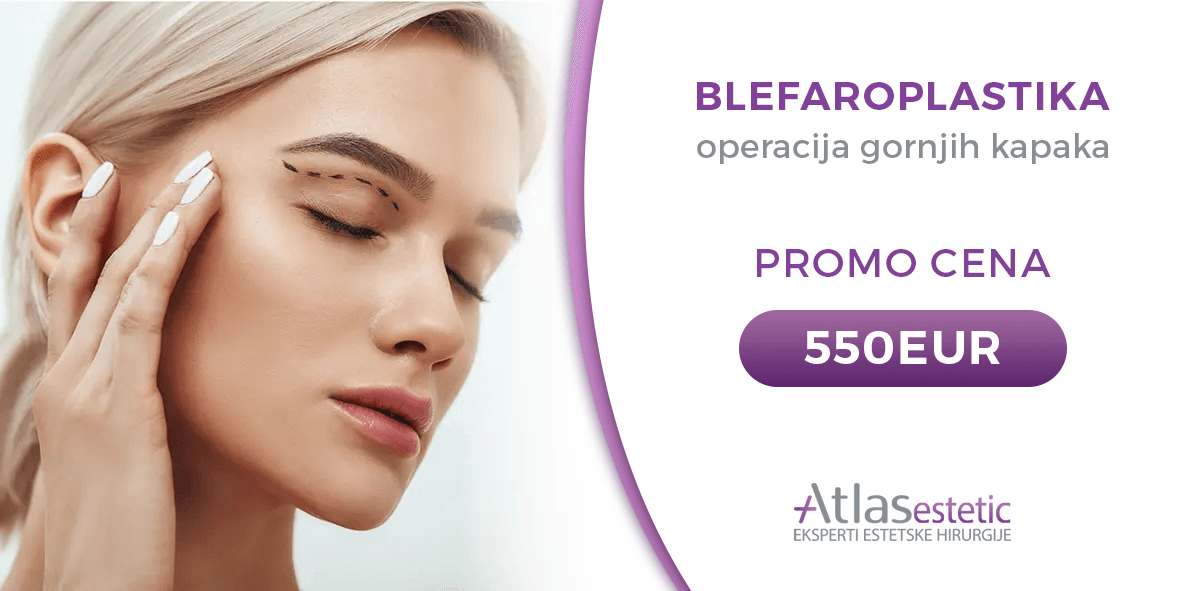 blefaroplastika