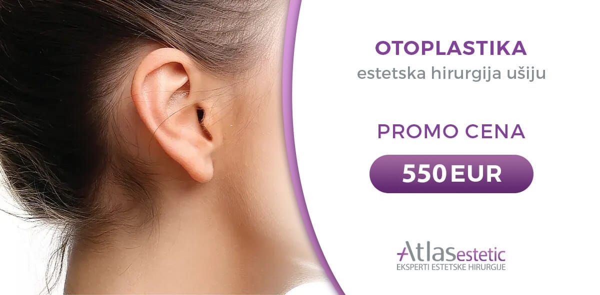 Usi otoplastika